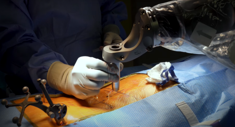 Robotics in Spine Surgery | Advanced Robotic Spine Surgery in Bareilly | Rohilkhand Medical College and Hospital